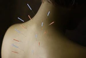  How Acupuncture Works